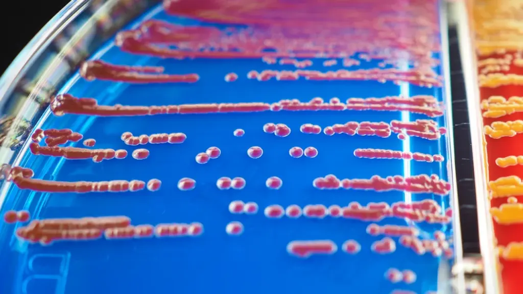 Serratia marcescens bakterikolooniad laboratoorsel agarsöötmel, mis illustreerivad toidutekkelisi patogeene ja nende laboratoorset analüüsi.